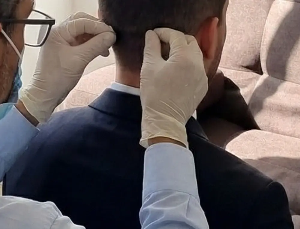 Toma de muestra del test epigenético, con kit de cabello